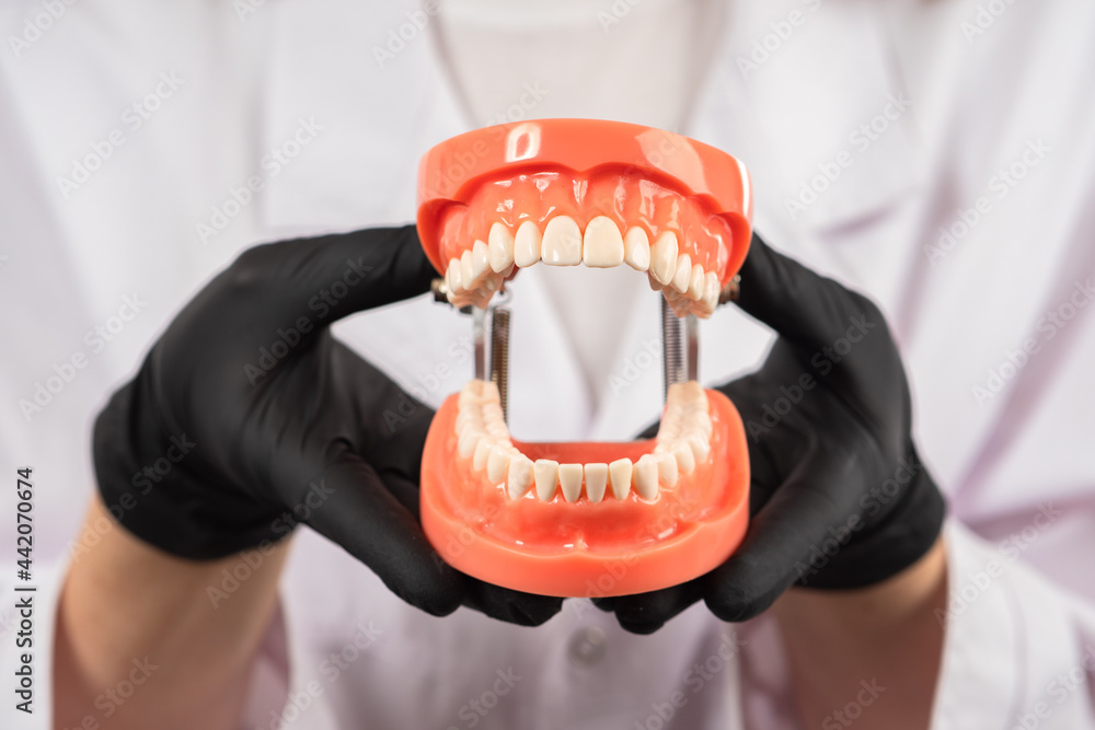 Dental model of the jaw in the hands of a doctor or teacher. Open model ...