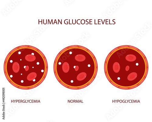 Flat illustrations of human glucose levels
