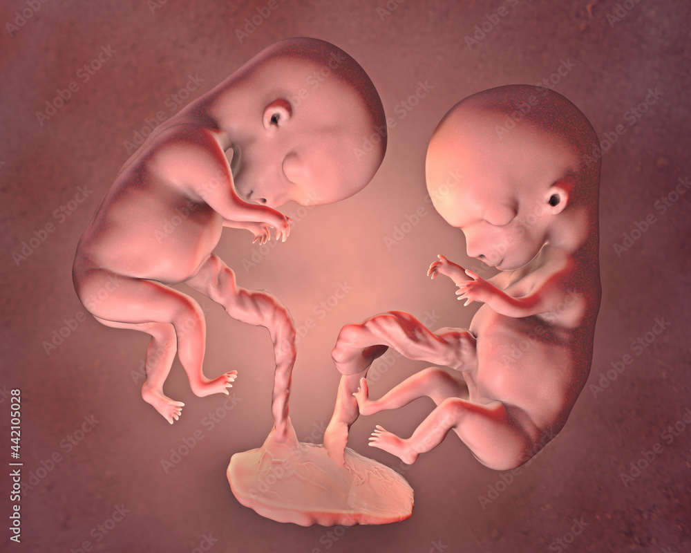 Monozygotic twins in uterus with single placenta, 3D illustration
