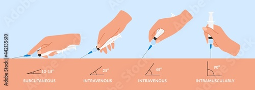 Types injections. Guide to injecting vaccines into skin. Hands holds syringes at different angles. Doctors' arms vaccinate patients. Vector medical procedure manuals for hospital workers
