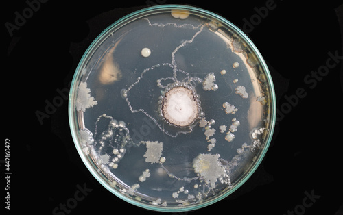 Top view fungus contaminated on nutrient agar in plate black background.