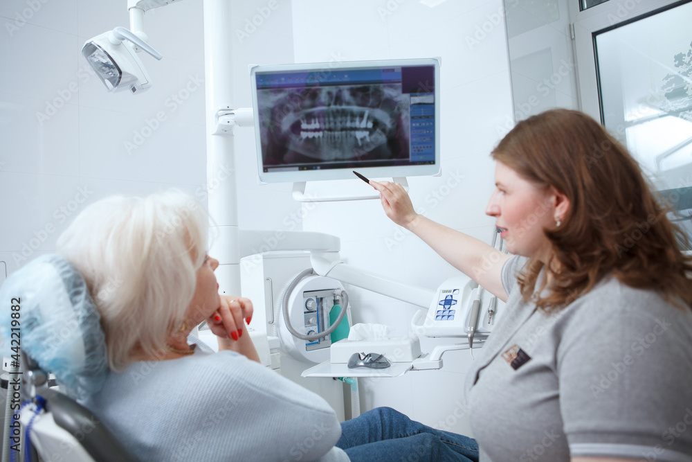 Female dentist showing dental x-ray scan to her senior patient Female dentist showing dental x-ray scan to her senior patient