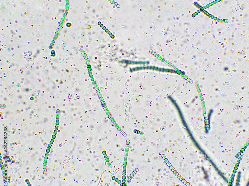 Nostoc sp. algae under microscopic view, Cyanobacteria, Blue green