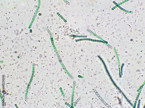 Nostoc sp. algae under microscopic view, Cyanobacteria, Blue green algae photo