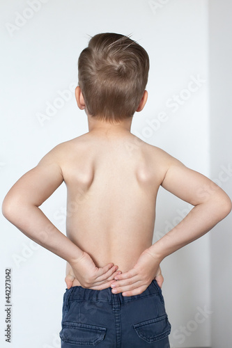 kid with scoliosis, isolated on white background. photo