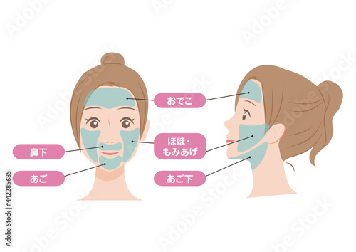 女性の顔の脱毛箇所のイラスト