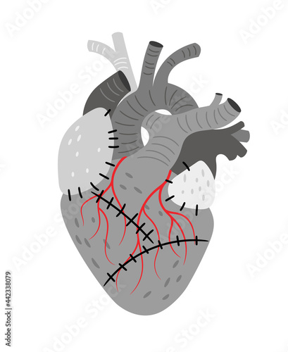 Anatomical organ, heart with stitches