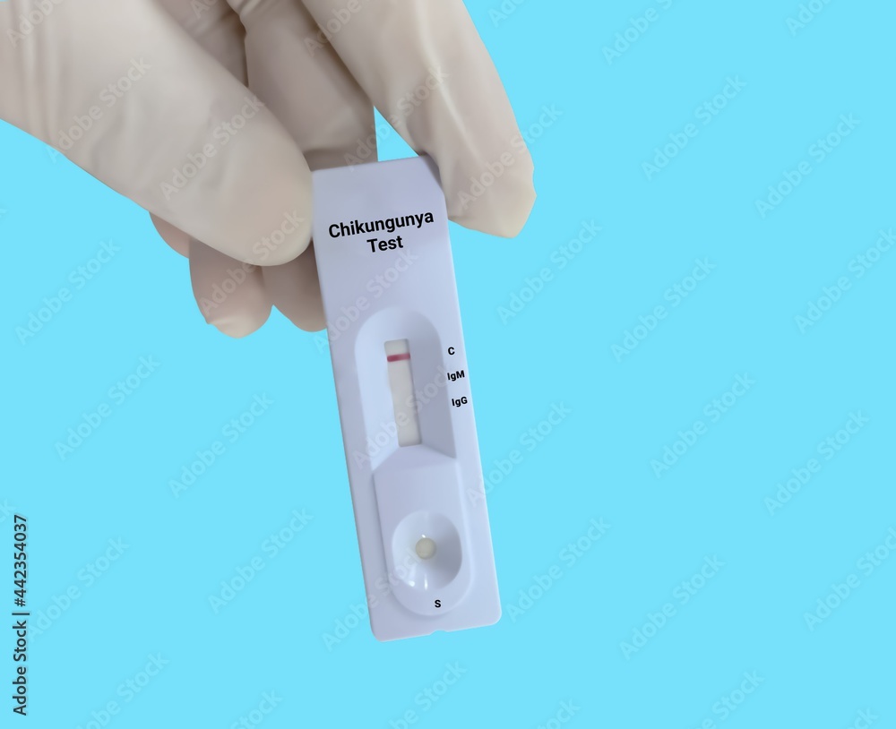 Scientists or Lab Technologists hold a device of chikungunya IgG, IgM rapid screening test, showing negative results.