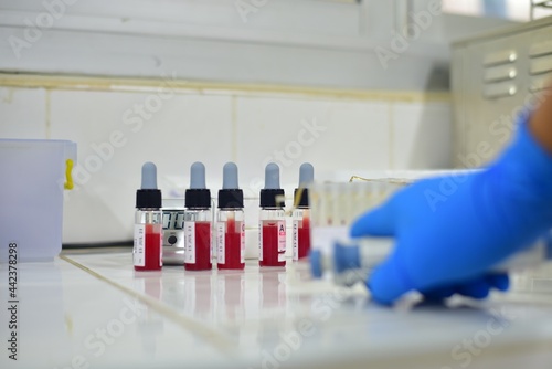 Gel colume agglutination in blood bank laboratory. photo