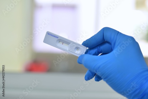 Hand scientist testing lab on blur background.