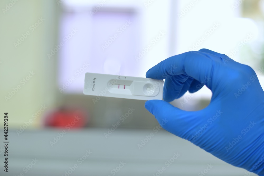 Hand scientist testing lab on blur background.