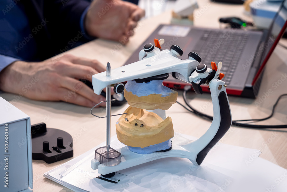 Diagnostic articulator in dentist office. Articulator with a fixed denture. Orthodontic