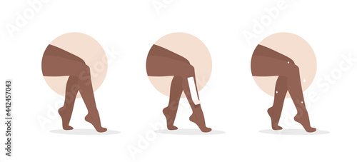 Hair removal. Waxing or sugaring process with strips. African female legs. Skin care. Before and after. Step by step procedure of epilation. Beauty salon. Vector illustration in flat cartoon style.