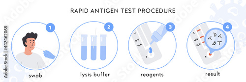 Covid-19 Rapid Antigen test procedure Infographic. A doctor takes nasal swab from male patient. Coronavirus swap sample in lysis buffer, strip with reagents and result with antigen molecules. Vector. photo