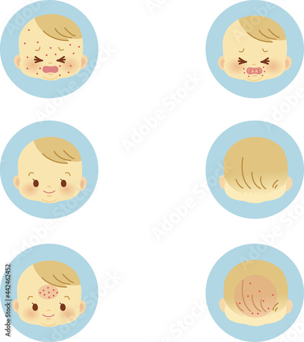 イラスト素材:かわいい赤ちゃんが喜怒哀楽の表情を見せるアイコンマークシリーズ　あせも等　主線なし4
