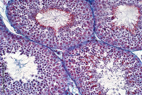 Human testis under the light microscope view. Shows spermatogonia, spermatocytes in meiosis, spermatids, and spermatozoa. photo