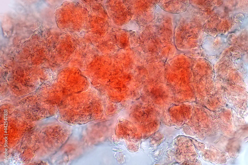 Εκτύπωση καμβά Adipose tissue under microscope view show contains large lipid droplet