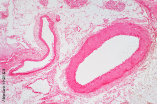 Artery vascular cross section under the light microscope view . photo
