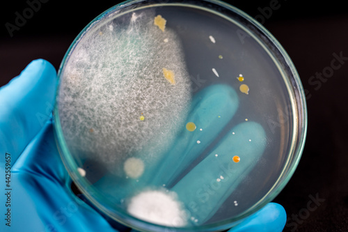 Backgrounds of Characteristics and Different shaped Colony of Bacteria and Mold growing on agar plates from Soil samples for education in Microbiology laboratory. 