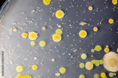 Backgrounds of Characteristics and Different shaped Colony of Bacteria and Mold growing on agar plates from Soil samples for education in Microbiology laboratory. 