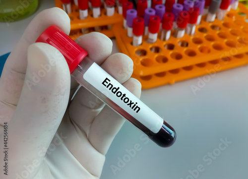 Blood sample for Endotoxin test, Limulus amebocyte lysate photo