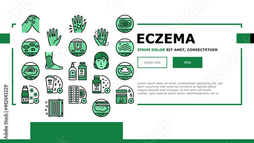 Eczema Disease Treat Landing Header Vector. Nummular And Neurodermatitis Eczema Treatment, Dry Skin And Pain, Contact And Atopic Dermatitis. Illustration