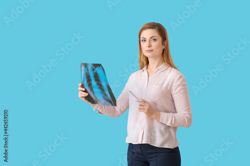 Woman with x-ray image of l...
