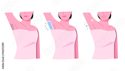 Waxing armpit hair. Hair removal, care concept person vector illustration.