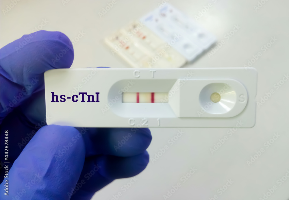 Scientist hold rapid test cassette for hs-cTnI (high sensitive Troponin I), diagnosis of myocardial infraction. Scientist hold rapid test cassette for hs-cTnI (high sensitive Troponin I), diagnosis of myocardial infraction.