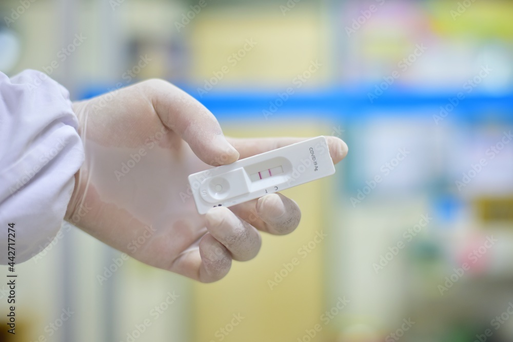 Strip test Covid-19 antigen positive. Strip test Covid-19 antigen positive.