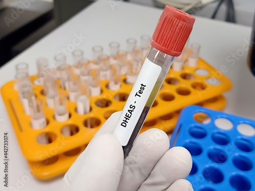 Test Tube with blood sample for DHEAS (dehydroepiandrosterone sulfate) hormone test. A medical testing concept in the laboratory background. photo