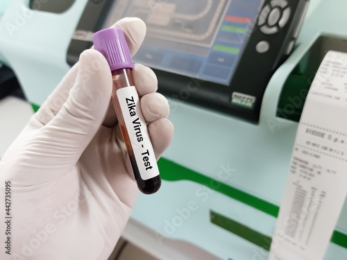 Biochemist or Lab Technologist holds Blood samples for Zika virus test in the laboratory background. Zika virus test concept photo with a blood sample.  photo