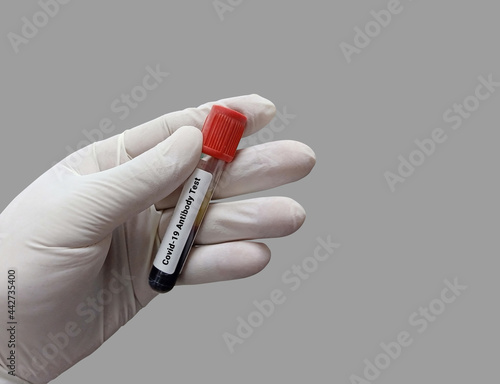 Biochemist or Lab Technologist holds Blood samples for Covid-19 antibody test in the laboratory. Biochemistry lab Close view. IgG, IgM test of Covid-19.