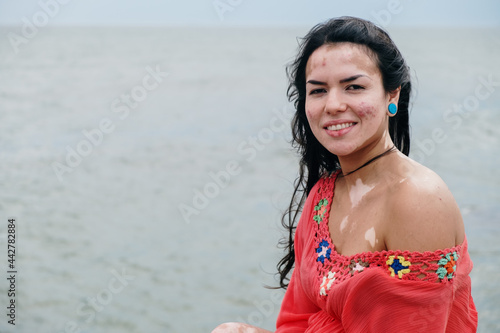 Bild auf Leinwand Beautiful latin girl with vitiligo on the beach