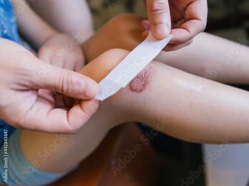 A man's hand sticks a Band-Aid on the damaged skin on the child's leg.An abrasion and a scratch on the knee.