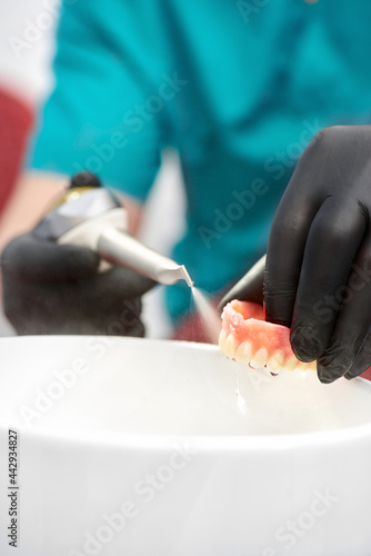 Orthodontist is working on cast of jaw. Orthodontics. Orthodontist makes a denture.