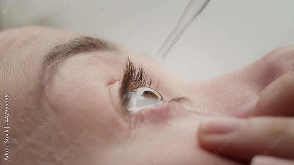 Close-up shooting of dripping into eyes from an eyedropper. Vision treatment, prevention of visual diseases, health care and medicine concept. Advertising of eye drops from allergies. Close-up shooting of dripping into eyes from an eyedropper. Vision treatment, prevention of visual diseases, health care and medicine concept. Advertising of eye drops from allergies.