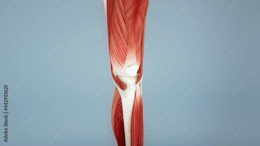 Knee surgery, torn tendon repair, ligament repair, pins, bone drilling