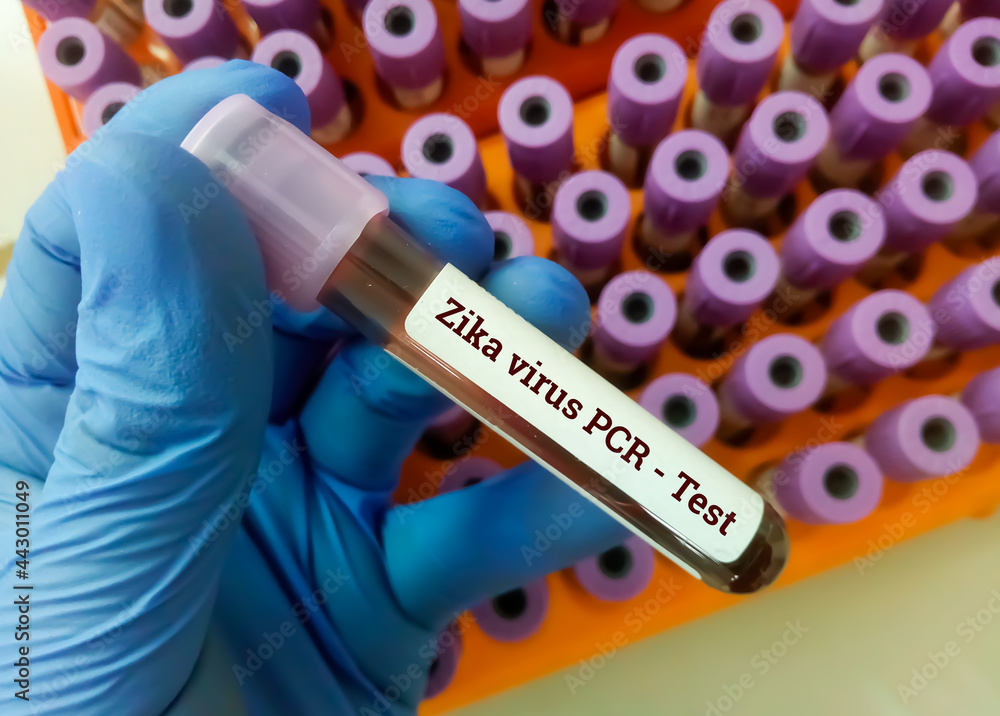 Obraz premium Blood sample for Zika virus PCR test
