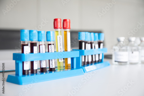 Vascular samples of COVID-19 patients in a hospital laboratory