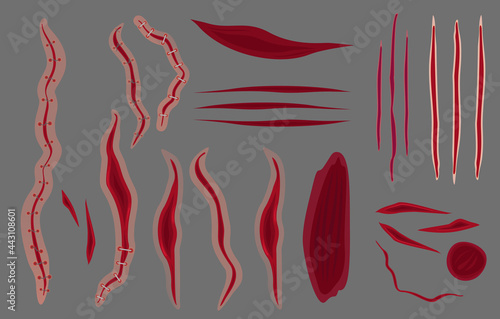 Vector illustration set of stitches, scars on grey background. Bruise and slaughters collection in flat style