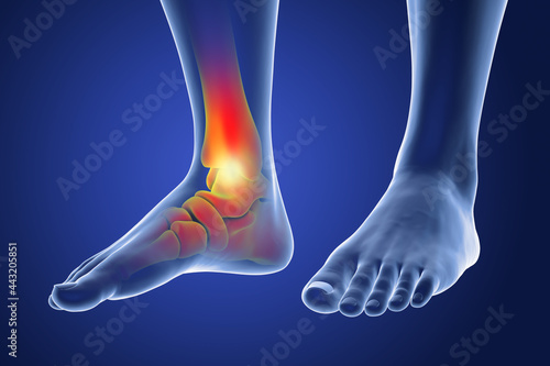 Foot and ankle pain, conceptual 3D illustration © Dr_Microbe