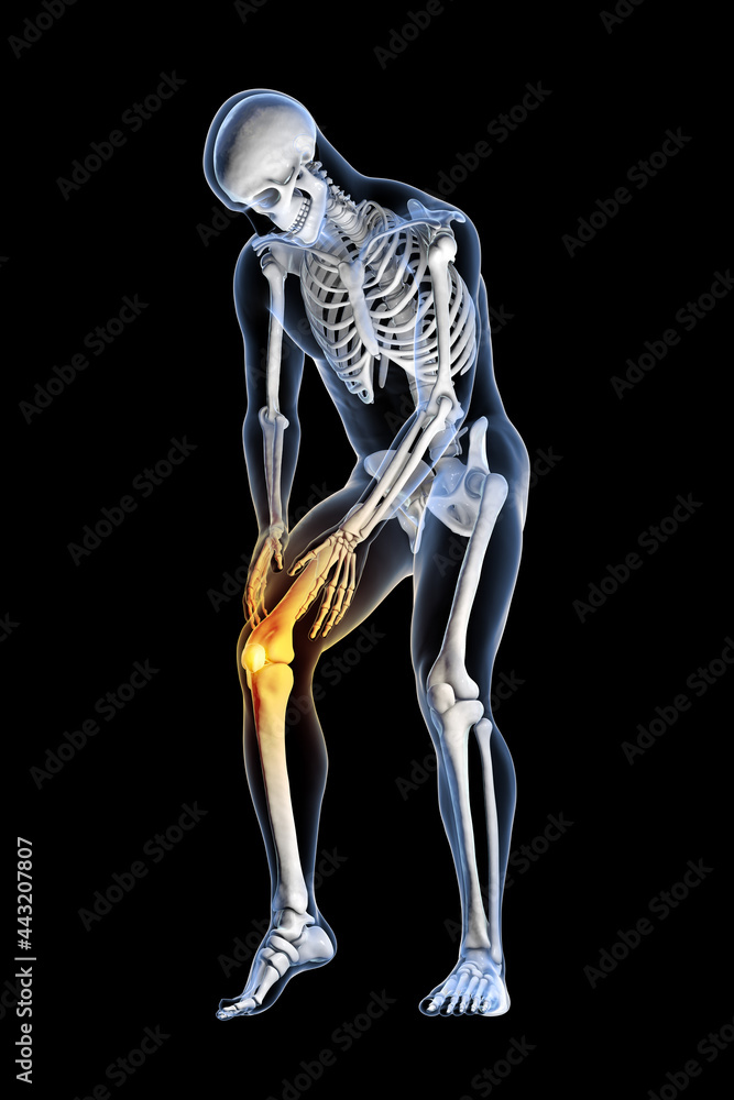 Painful knee, anatomy and medicine concept Painful knee, anatomy and medicine concept
