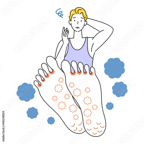 スキンケア 足が水虫になってしまい悲しんでいる可愛い男性 足裏のアップ イラスト ベクター