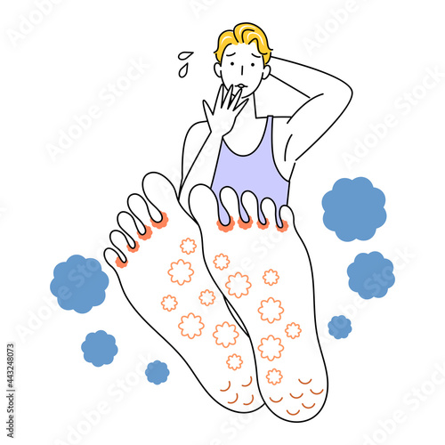 スキンケア 足が水虫になってしまい悲しんでいる可愛い男性 足裏のアップ イラスト ベクター