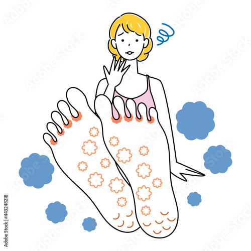 スキンケア 足が水虫になってしまい悲しんでいる可愛い女性 足裏のアップ イラスト ベクター