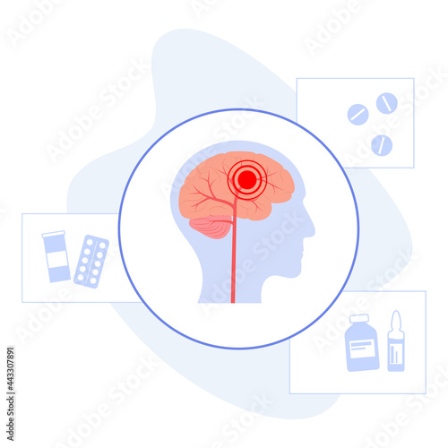 Brain pain disease