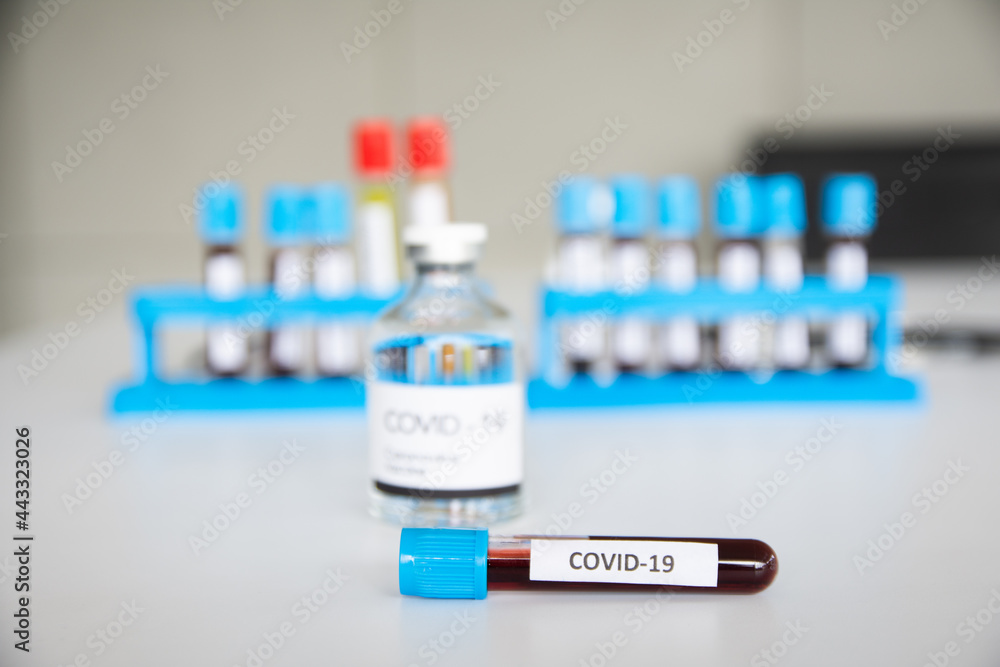 Vascular samples of COVID-19 patients in a hospital laboratory