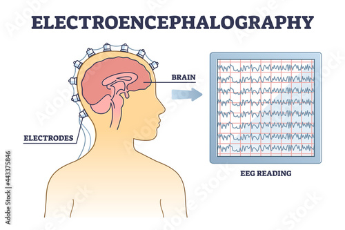 Electroencephalography or EEG as brain activity monitoring outline diagram. Medical health examination with electrodes and reading monitor vector illustration. Head measurement process explanation. photo