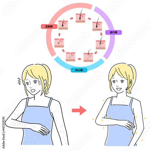 脱毛イメージ女性